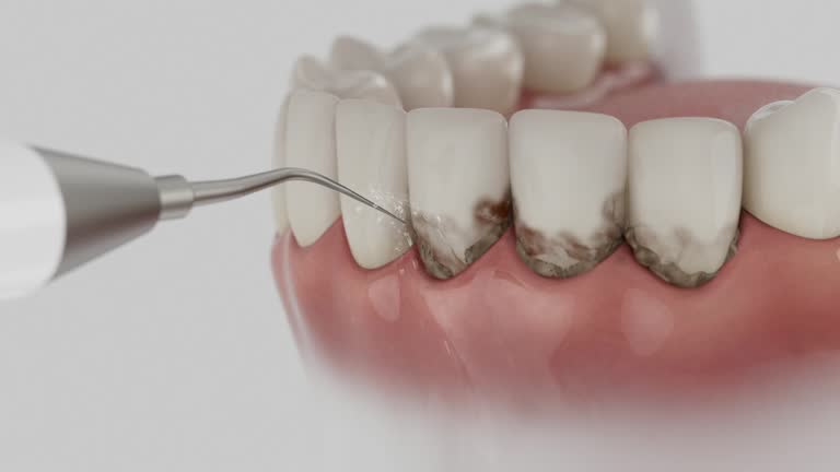 Reliable Dental Implants contractor in Newton, KS by Smile Center Dentistry